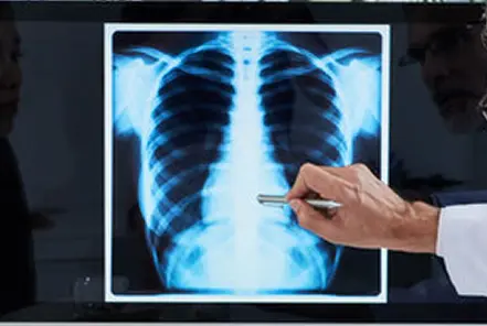 chest xray examination